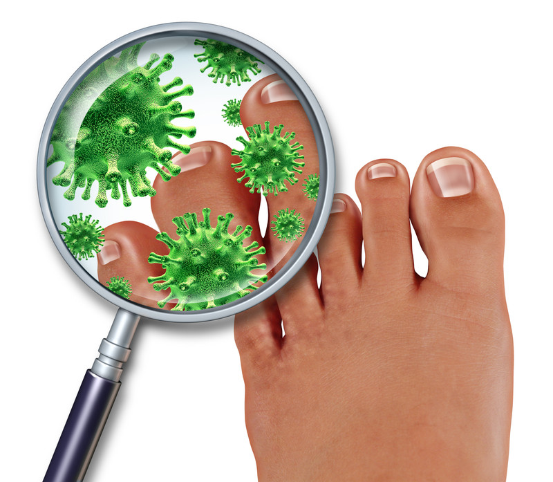Antifungal Manufacturers In Germany